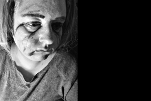 Ein Schwarz-Weiß-Foto einer Frau mit blauen Flecken im Gesicht, ernster Miene und konzentriertem Blick, die ein T-Shirt trägt und ihr Haar zurückgebunden hat.